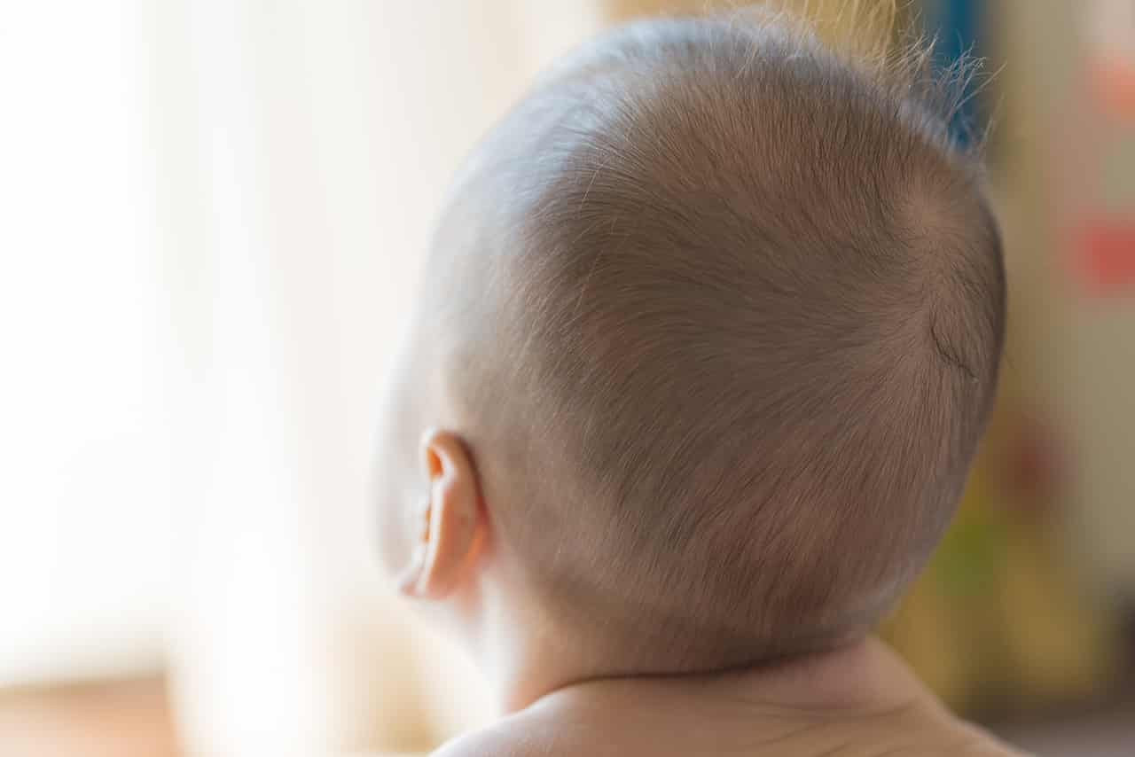 赤ちゃんの頭皮が乾燥する原因とは 乾燥を予防する方法について Fam S Baby