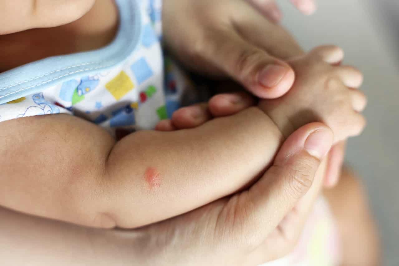 赤ちゃん 蚊 に 刺され た 赤ちゃんに蚊に刺されたような赤く腫れた発疹が 効いた薬