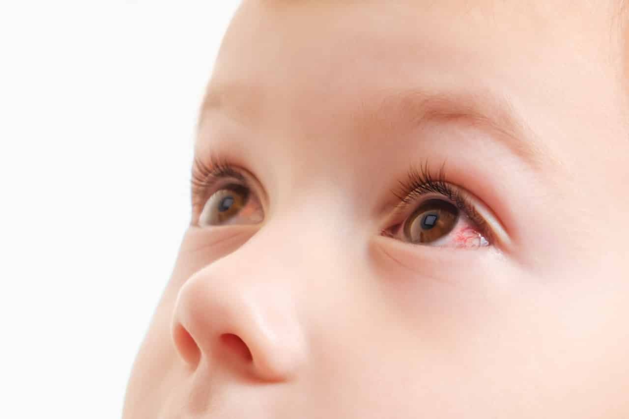 赤ちゃんの目やにの原因とは 目やにを上手に取るコツもご紹介 Fam S Baby