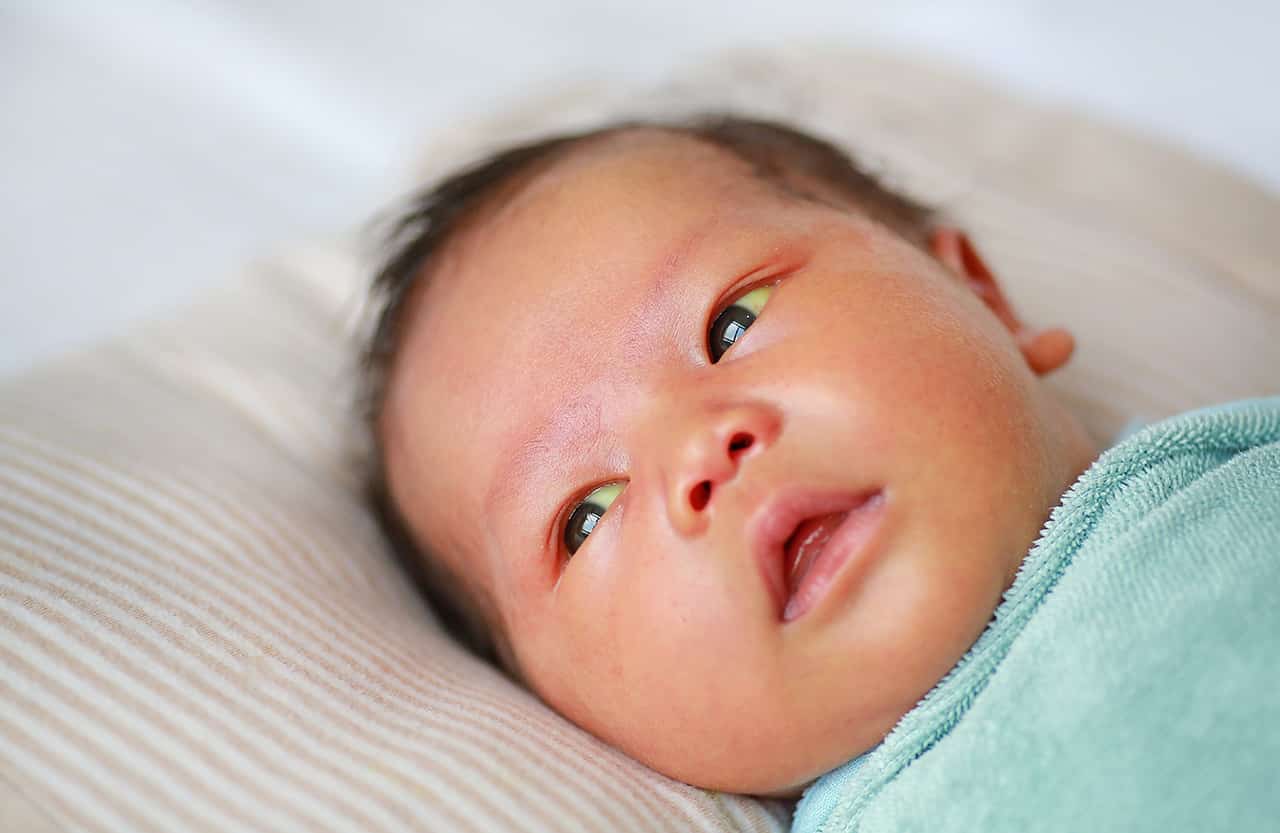 赤ちゃんの黄疸はよく出るもの 症状と注意が必要な場合について解説 Fam S Baby