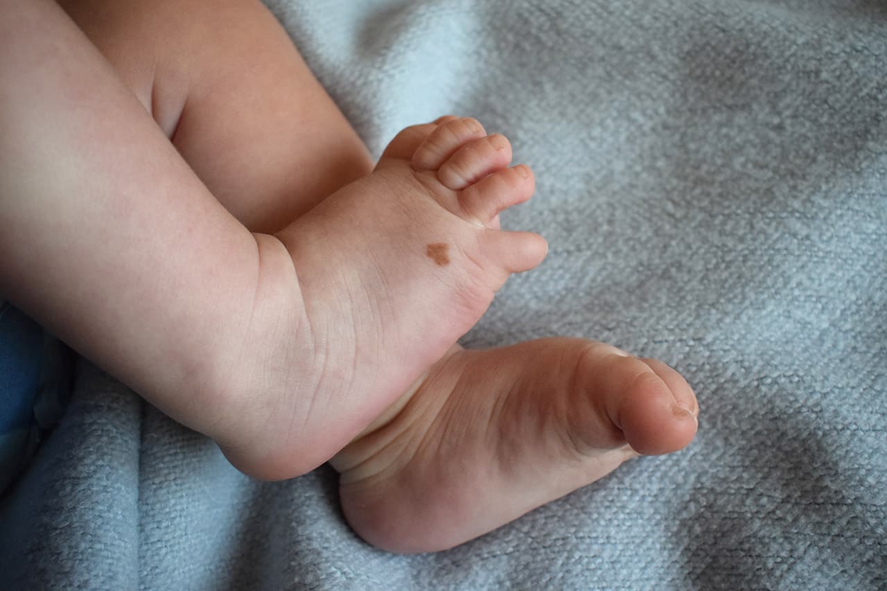 赤ちゃんにほくろができるのはいつ頃 ほくろの種類と対処法についても解説 Fam S Baby 赤ちゃんにほくろができるのはいつ頃 ほくろの種類と対処法についても解説 Fam S Baby